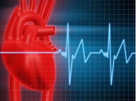 Что такое синусовая тахикардия сердца?