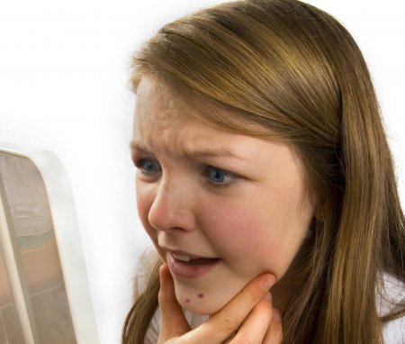 Что делать, если появилась сыпь на лице у взрослого?